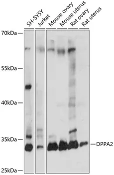 DPPA2 Rabbit Polyclonal Antibody - image 1