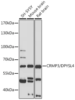 CRMP3 (DPYSL4) Rabbit Polyclonal Antibody - image 1