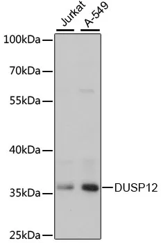 DUSP12 Rabbit Polyclonal Antibody - image 1