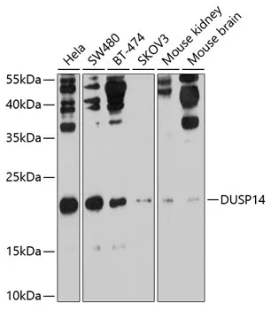 DUSP14 Rabbit Polyclonal Antibody - image 1