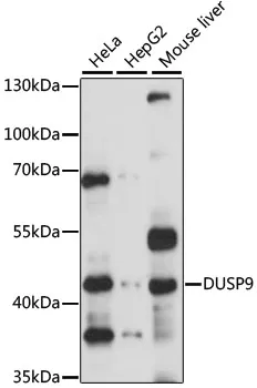 DUSP9 Rabbit Polyclonal Antibody - image 1