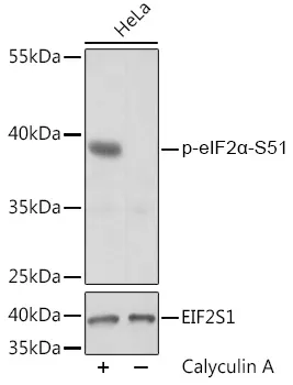 elF2 alpha (EIF2S1) Rabbit Polyclonal Antibody - image 1