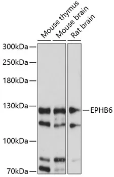 Eph receptor B6 (EPHB6) Rabbit Polyclonal Antibody - image 1