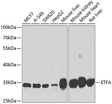 ETFA Rabbit Polyclonal Antibody - image 1