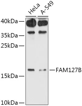 RTL8A Rabbit Polyclonal Antibody - image 1