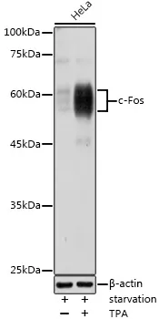 c Fos (FOS) Rabbit Polyclonal Antibody - image 1