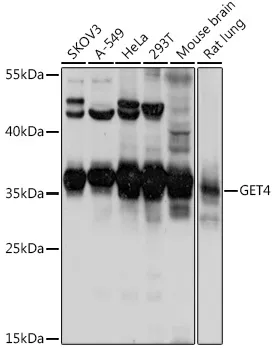 CEE (GET4) Rabbit Polyclonal Antibody - image 1