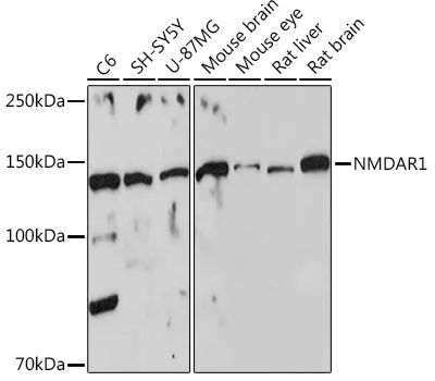NMDAR1 (GRIN1) Rabbit Polyclonal Antibody - image 1