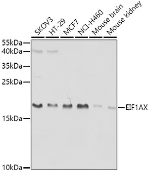 eIF1A (EIF1AX) Rabbit Polyclonal Antibody - image 1