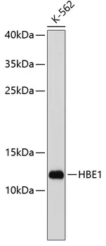 Hemoglobin subunit epsilon (HBE1) Rabbit Polyclonal Antibody - image 1