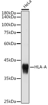 HLAA (HLA-A) Rabbit Polyclonal Antibody - image 1