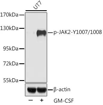 JAK2 Rabbit Polyclonal Antibody - image 1