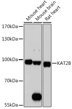KAT2B Rabbit Polyclonal Antibody - image 1