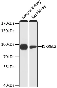 KIRREL2 Rabbit Polyclonal Antibody - image 1