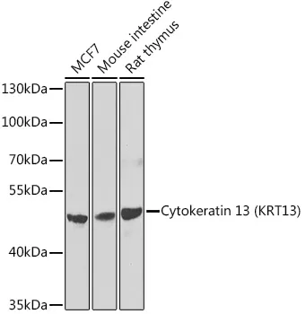 KRT13 Rabbit Polyclonal Antibody - image 1