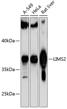 LIMS2 Rabbit Polyclonal Antibody - image 1