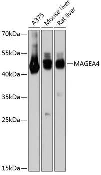 MAGEA4 Rabbit Polyclonal Antibody - image 1