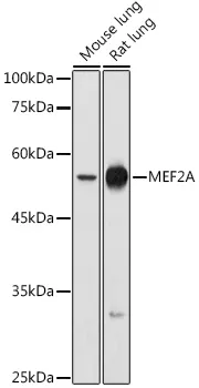MEF2A Rabbit Polyclonal Antibody - image 1