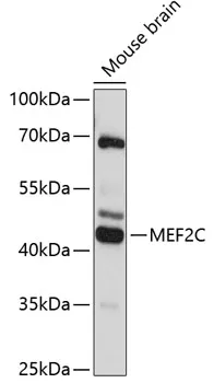 MEF2C Rabbit Polyclonal Antibody - image 1