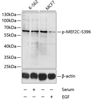 MEF2C Rabbit Polyclonal Antibody - image 1