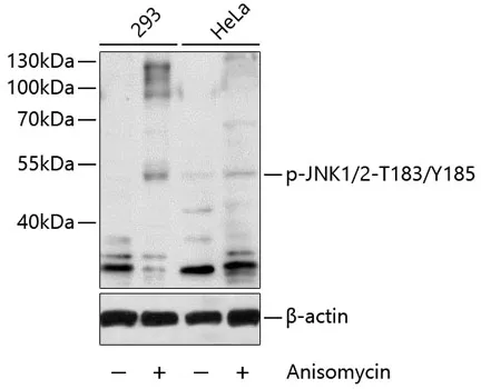 JNK1 (MAPK8) Rabbit Polyclonal Antibody - image 1