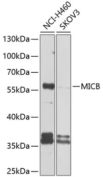 MICB Rabbit Polyclonal Antibody - image 1