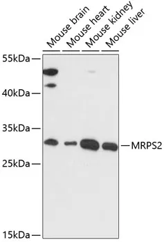 MRPS2 Rabbit Polyclonal Antibody - image 1