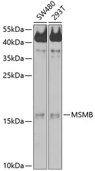 MSMB Rabbit Polyclonal Antibody - image 1