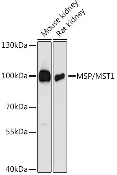 MST1 Rabbit Polyclonal Antibody - image 1