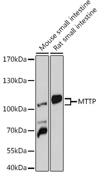 MTTP Rabbit Polyclonal Antibody - image 1