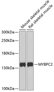 MYBPC2 Rabbit Polyclonal Antibody - image 1