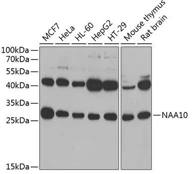 ARD1A (NAA10) Rabbit Polyclonal Antibody - image 1