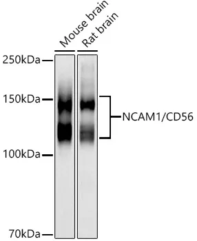 CD56 (NCAM1) Rabbit Polyclonal Antibody - image 1