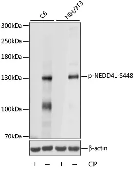 NEDD4 2 (NEDD4L) Rabbit Polyclonal Antibody - image 1
