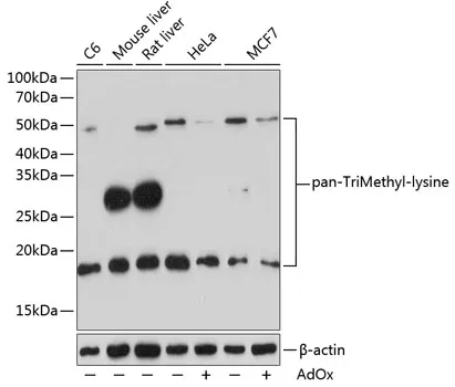 Tri-Methyl lysine Rabbit Polyclonal Antibody - image 1