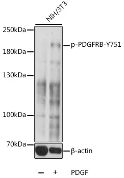 PDGF Receptor beta (PDGFRB) Rabbit Polyclonal Antibody - image 1