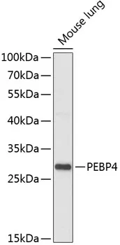 PEBP4 Rabbit Polyclonal Antibody - image 1