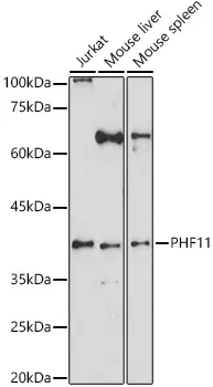 PHF11 Rabbit Polyclonal Antibody - image 1