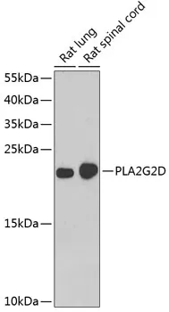PLA2G2D Rabbit Polyclonal Antibody - image 1