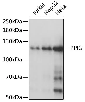 PPIG Rabbit Polyclonal Antibody - image 1