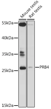 PRB4 Rabbit Polyclonal Antibody - image 1