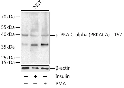 PRKACA Rabbit Polyclonal Antibody - image 1