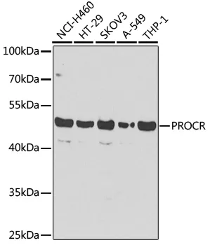 PROCR Rabbit Polyclonal Antibody - image 1