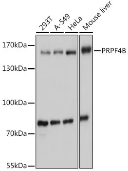 PRPF4B Rabbit Polyclonal Antibody - image 1