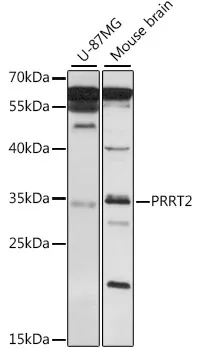 PRRT2 Rabbit Polyclonal Antibody - image 1