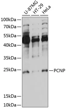 PCNP Rabbit Polyclonal Antibody - image 1