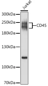 CD45 (PTPRC) Rabbit Polyclonal Antibody - image 1
