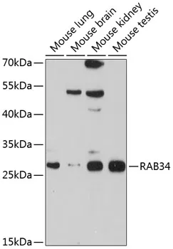 RAB34 Rabbit Polyclonal Antibody - image 1