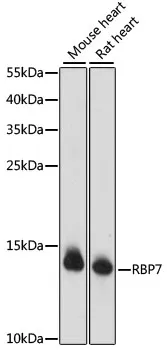 RBP7 Rabbit Polyclonal Antibody - image 1