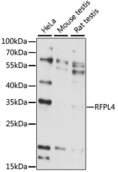 RFPL4A Rabbit Polyclonal Antibody - image 1